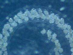 Many corals capture zooplankton for a meal.
